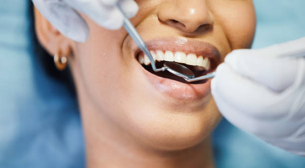 Best Emergency Wisdom Teeth Removal in Romancoke, MD